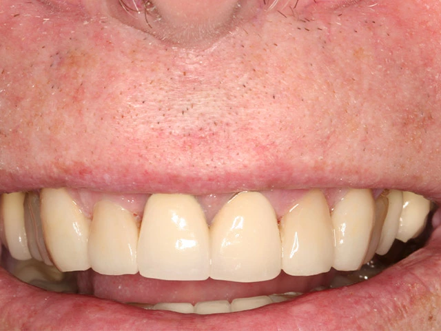 After image