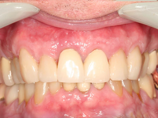 After image